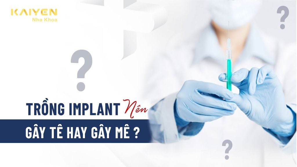 Gây Tê Hay Gây Mê Trong Cấy Ghép Implant