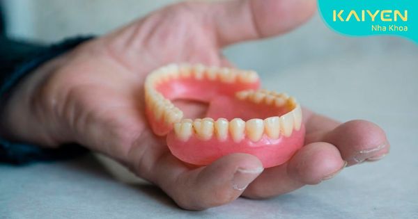 Hàm răng giả bị lỏng: Nguyên nhân và cách xử lý tức thì