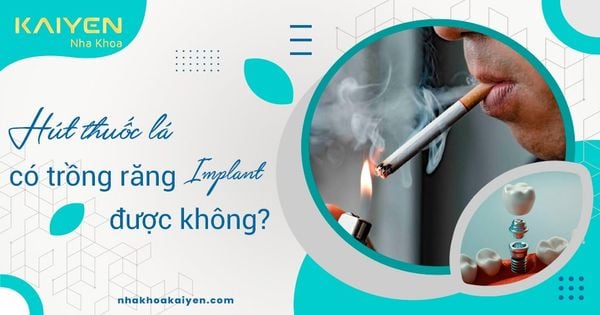Hút thuốc lá có trồng răng Implant được không?