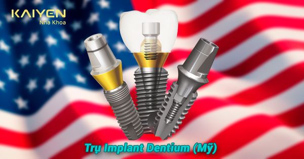 Trụ Implant Dentium Mỹ: Cấu tạo, tính năng và giá thành