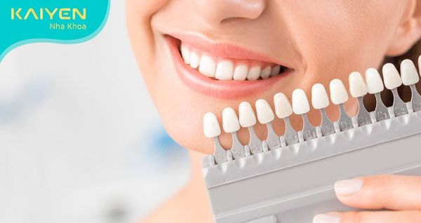 [CHIA SẺ] TOP 6 kinh nghiệm bọc răng sứ an toàn và chất lượng nhất