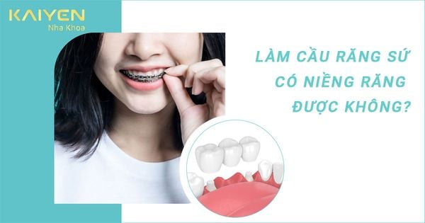 [Giải đáp] Làm cầu răng sứ có niềng răng được không?