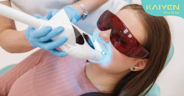Làm trắng răng tại nha khoa: Các phương pháp và mức giá chi tiết