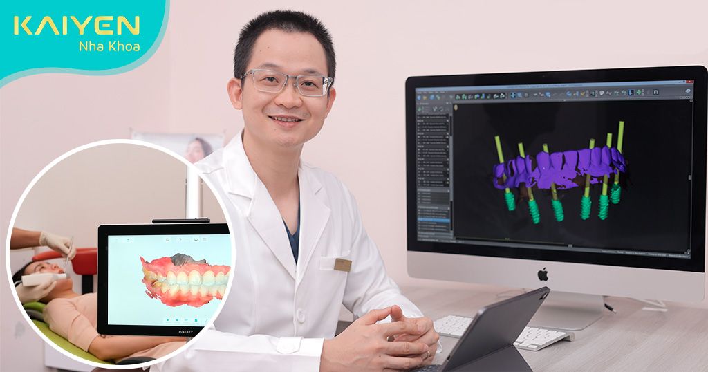 Lấy dấu phục hình trên Implant và quy trình phục hình chi tiết