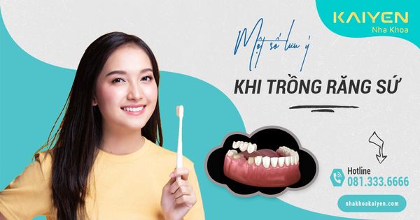 4 lưu ý khi trồng răng sứ giúp răng bền đẹp theo thời gian