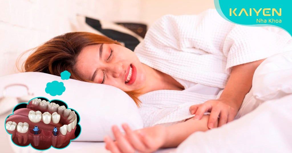 Nghiến răng ảnh hưởng đến răng Implant như thế nào? Cách điều trị