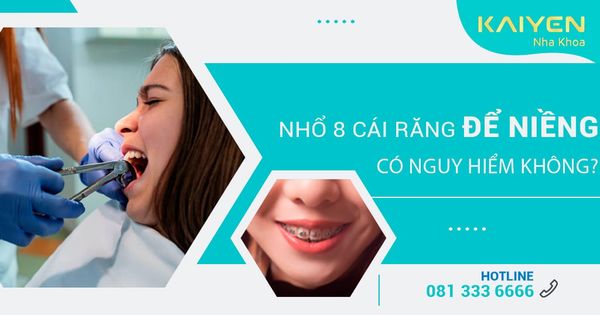 Nhổ 8 cái răng để niềng có nguy hiểm không? Trường hợp nào nên nhổ?