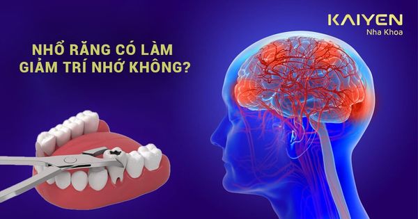 [Giải đáp] Nhổ răng có làm giảm trí nhớ không?