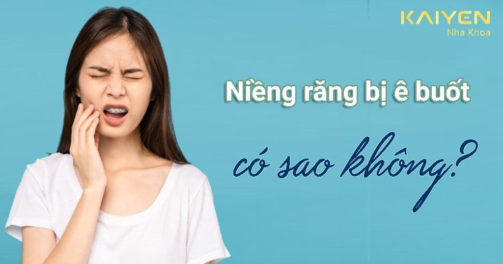 Niềng răng bị ê buốt có sao không? Cách xử lý tốt nhất