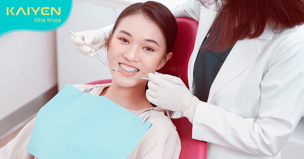 Có nên niềng răng ở người lớn không? Chi phí niềng bao nhiêu?