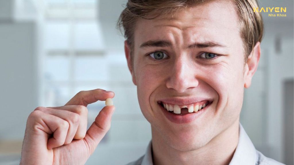 Răng bị gãy ngang phải làm sao? Chuyên gia giải đáp