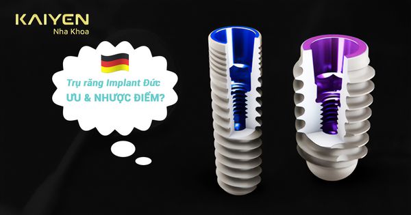 Trụ răng Implant Đức có mấy loại? Trồng loại nào tốt?