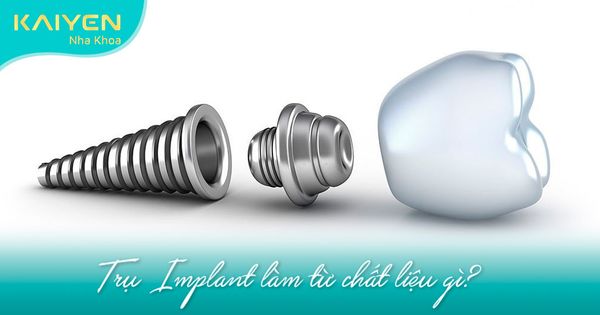 Răng Implant làm từ chất liệu gì? Đặc tính an toàn, tương thích sinh học