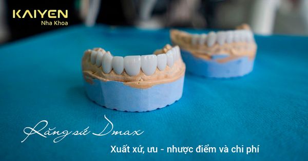 Răng sứ Dmax: Xuất xứ, ưu nhược điểm và chi phí thực hiện