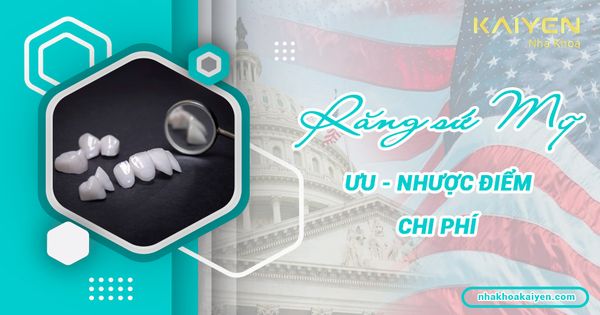 Review ưu – nhược điểm răng sứ Mỹ? Giá bao nhiêu?