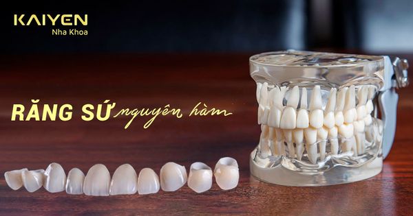 Làm răng sứ nguyên hàm: Những vấn đề cần quan tâm