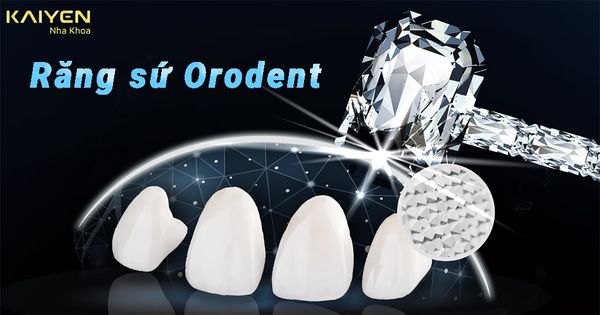 Răng sứ Orodent – Dòng răng sứ thẩm mỹ đến từ Ý an toàn nhất thế giới