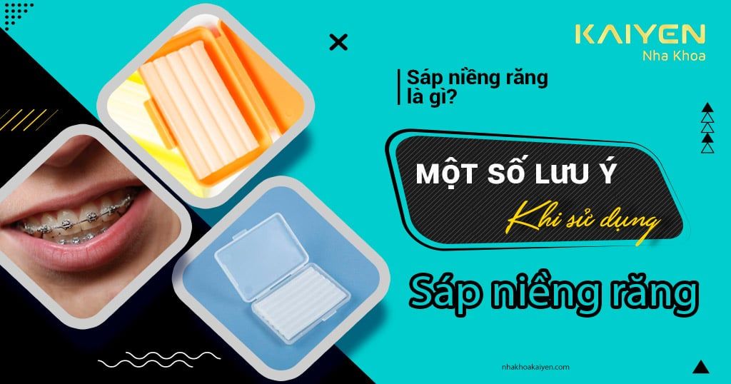Sáp niềng răng là gì? Cách dùng và những lưu ý cần biết