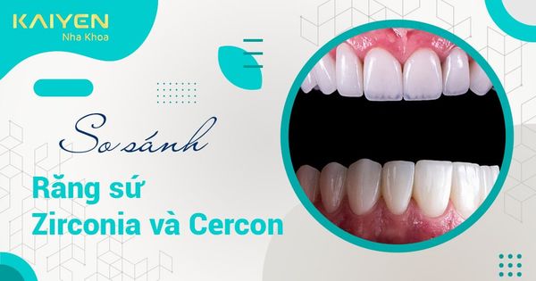 So sánh răng sứ Zirconia và Cercon - Nên chọn loại nào tốt?
