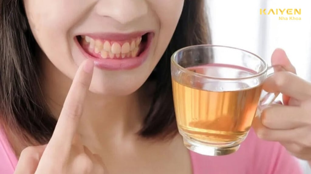 Trà có thể gây ố vàng răng