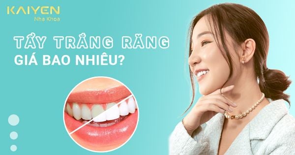 [Cập nhật bảng giá] Tẩy trắng răng giá bao nhiêu tiền?