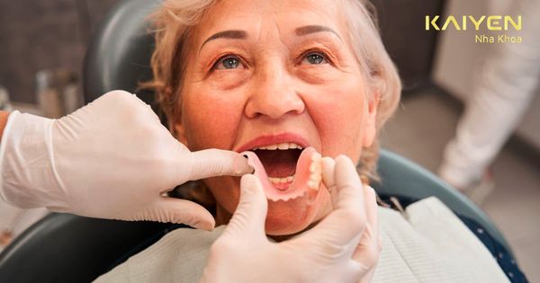 Trồng răng cho người già: Đâu là giải pháp an toàn, thích hợp?