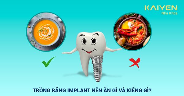 Trồng răng Implant bao lâu thì ăn được? Nên ăn gì, kiêng gì?
