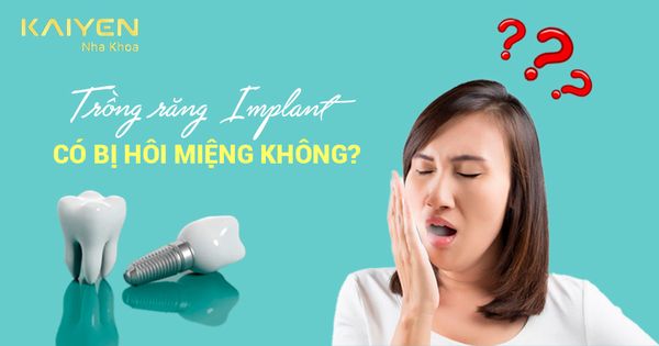 Trồng răng Implant có bị hôi miệng không? Nguyên nhân và cách xử lý