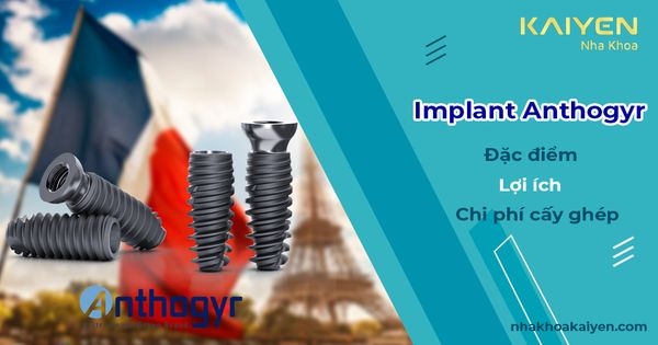 Trụ Implant Anthogyr: Đặc điểm, lợi ích và chi phí cấy ghép