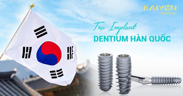 Trụ Implant Dentium Hàn Quốc: Cấu tạo, tính năng và quy trình thực hiện