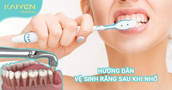 Hướng dẫn cách chăm sóc và vệ sinh răng sau khi nhổ