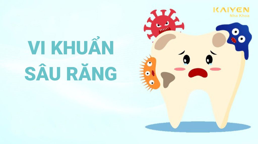 Vi khuẩn sâu răng và mức độ ảnh hưởng đến cơ thể