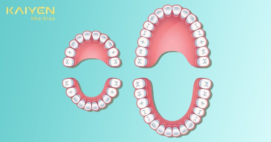 Trẻ đã thay toàn bộ răng sữa thì có thể bọc răng sứ