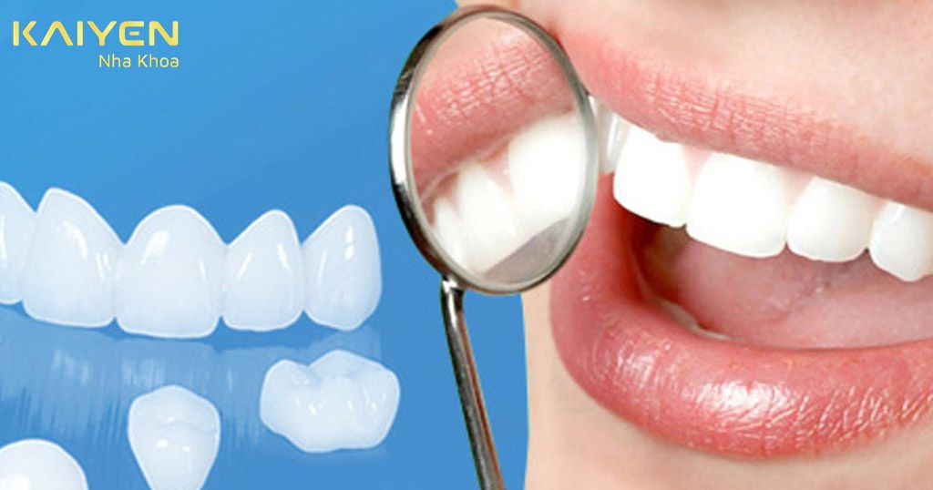 Làm răng sứ nên hạn chế tối đa đồ ăn cứng để răng bền lâu hơn