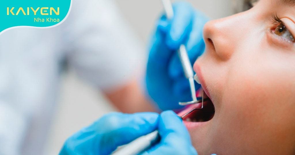 Khám chữa bệnh lý về răng thuộc dịch vụ được BHYT chi trả