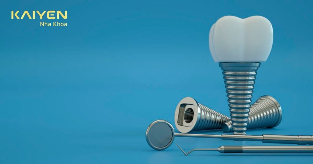 Vật liệu trụ Implant không tốt sẽ làm tăng khả năng xảy ra biến chứng