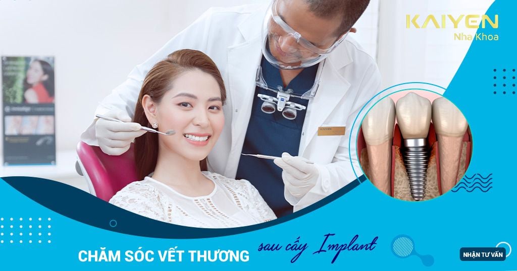 Chăm sóc vết thương sau cấy Implant