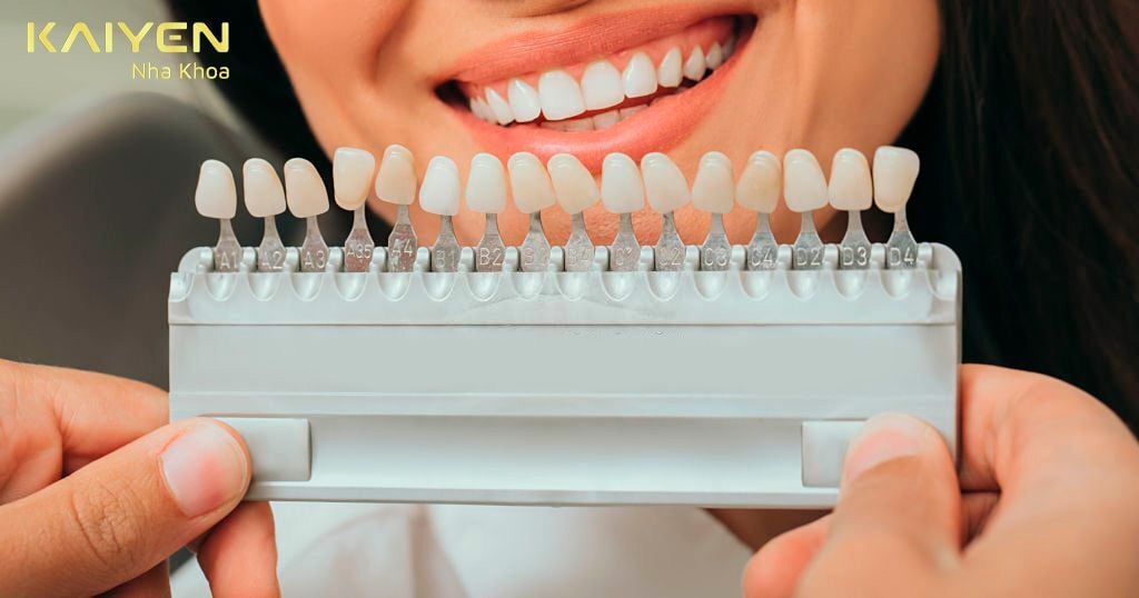 Dán răng sứ giúp mang lại hiệu quả cao về tính thẩm mỹ