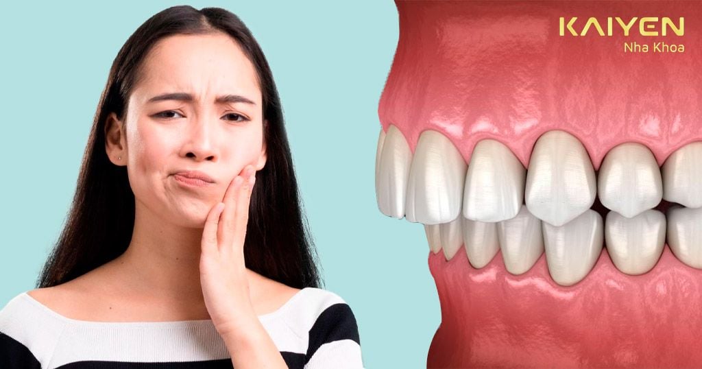 Răng hô kéo dài dẫn đến đau hàm, giảm chức năng ăn nhai