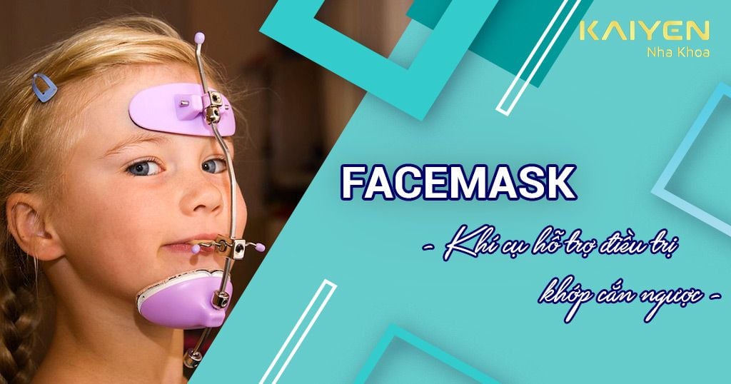 Facemask chỉnh nha hỗ trợ điều trị khớp cắn ngược ở trẻ