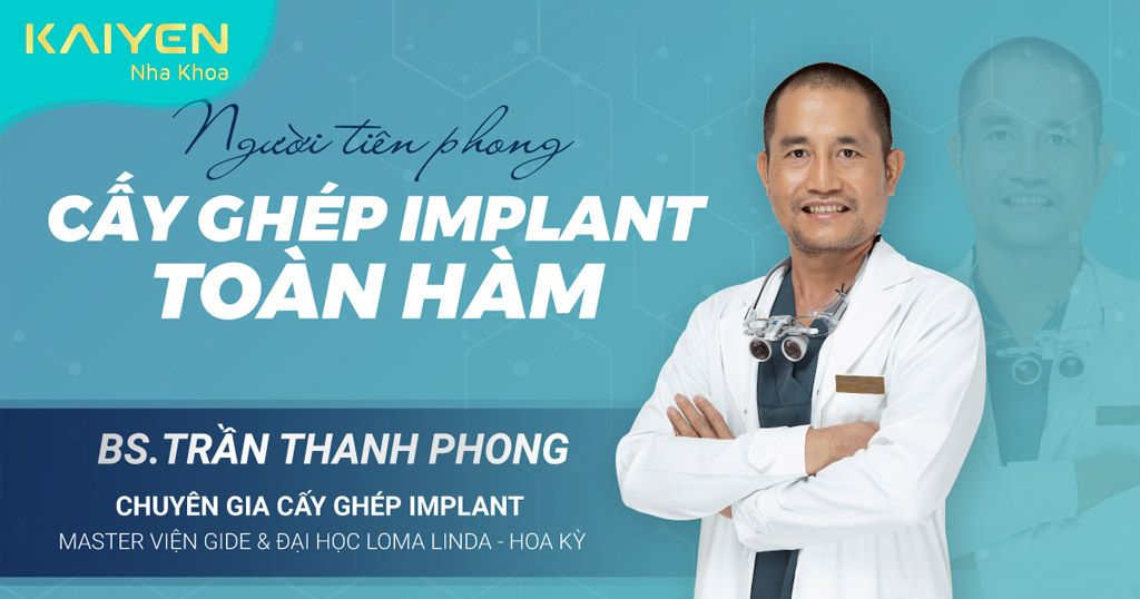 Cấy ghép Implant với bác sĩ giàu kinh nghiệm