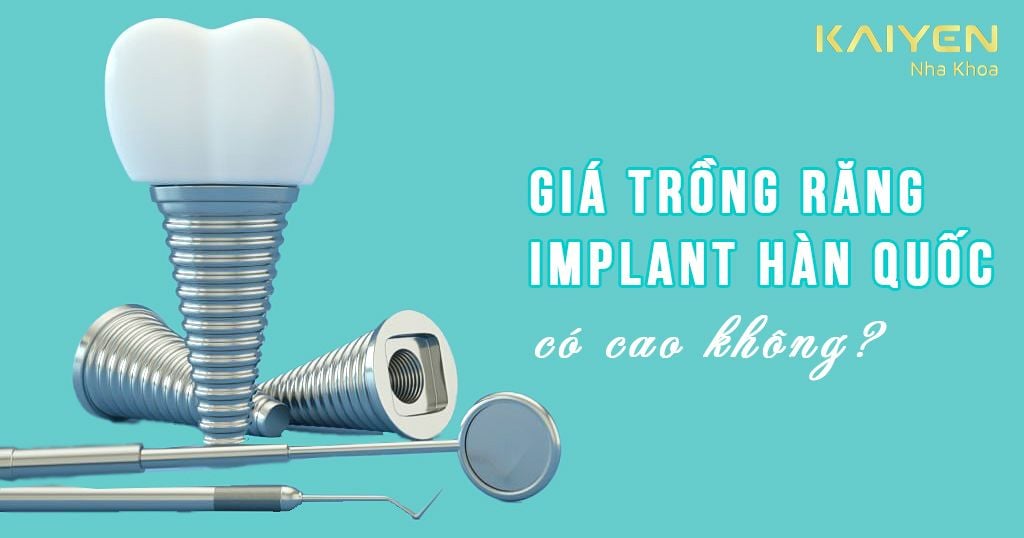 Giá trồng răng Implant Hàn Quốc có cao không?