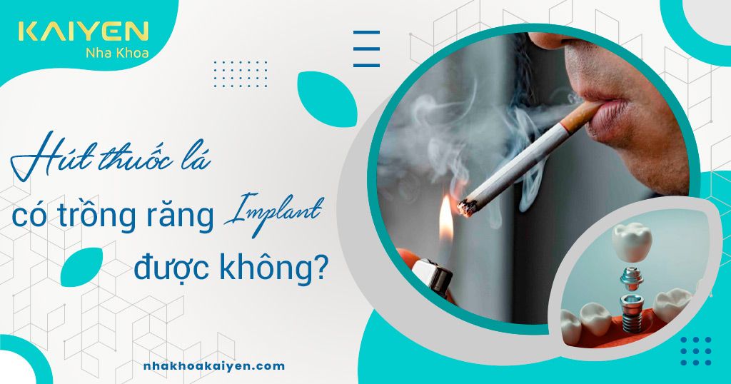 [giải đáp] Hút Thuốc Lá Có Trồng Răng Implant được Không Nha Khoa