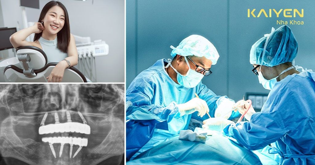 Nha khoa Quốc tế KAIYEN – Địa chỉ cấy ghép Implant chuyên sâu