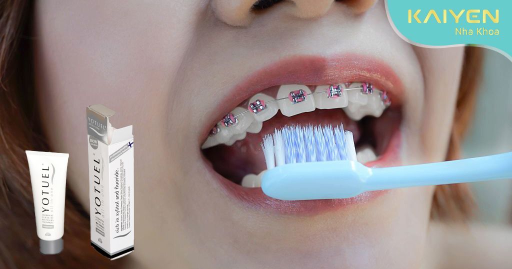 Kem đánh răng Yotuel All In One Intensive Whitening Toothpaste