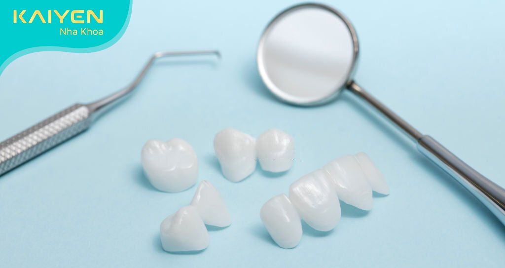 Kinh nghiệm bọc răng sứ quan trọng là lựa chọn loại răng sứ phù hợp