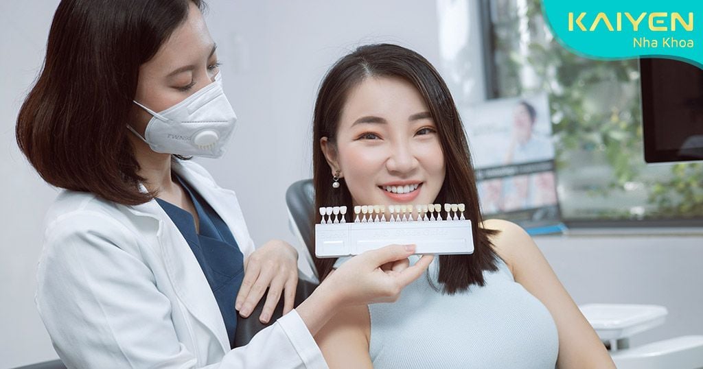 Quy trình dán răng sứ Veneer tại Nha khoa Kaiyen nghiêm ngặt và an toàn