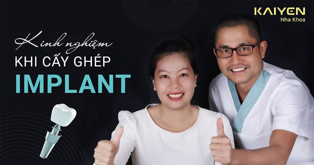 Kinh Nghiệm Trồng Răng Implant Bạn Phải Biết