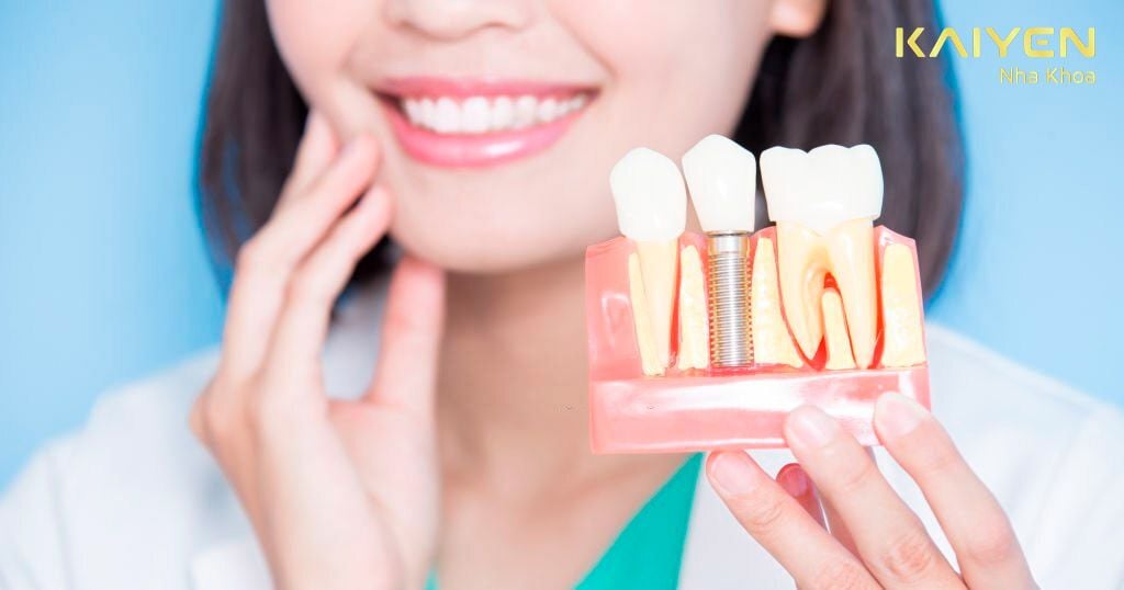 Kinh nghiệm trồng răng Implant có đau không?