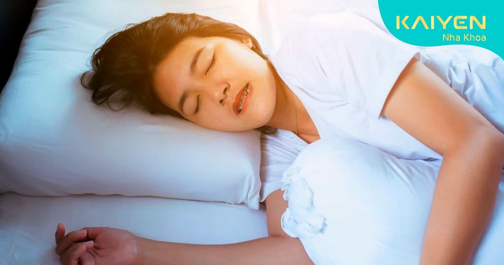 Đau răng sứ do thói quen nghiến răng khi ngủ